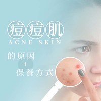 青春痘(痤瘡/面皰/粉刺/暗瘡)的成因與類型 - Simplism簡單保養