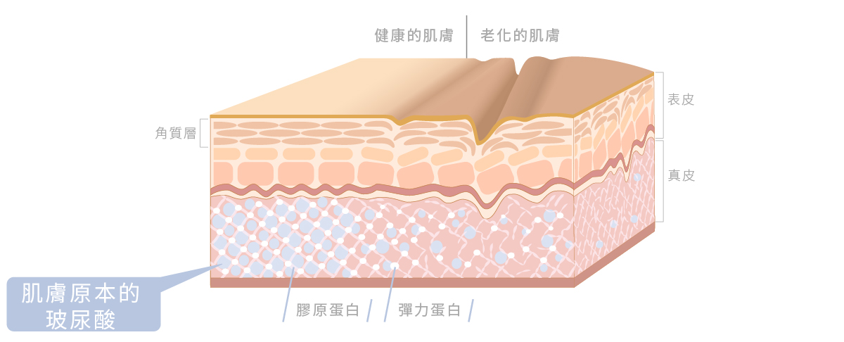 玻尿酸如何保濕