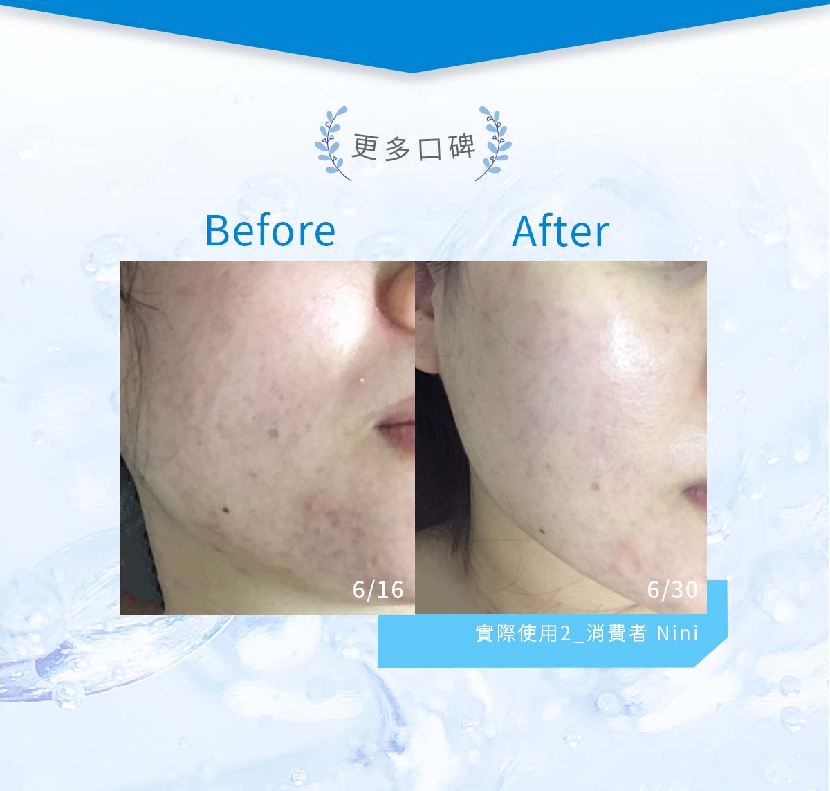 簡單保養角質調理露BA