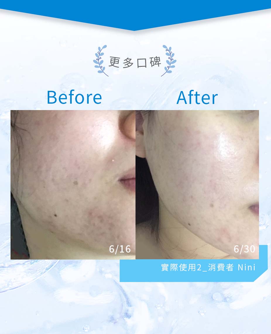 簡單保養角質調理露BA